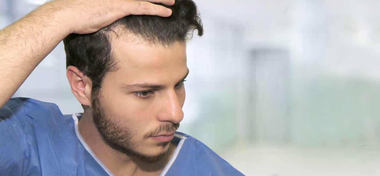 How Beat The Early Signs Of Hair Loss