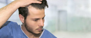 Hair Loss