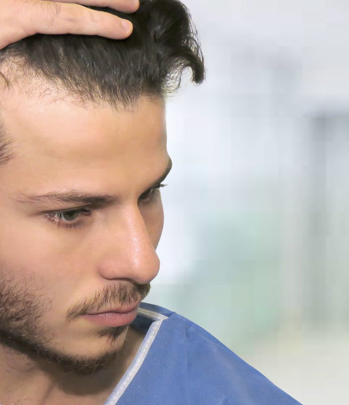 How Beat The Early Signs Of Hair Loss